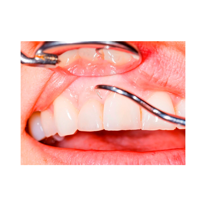 periodontia