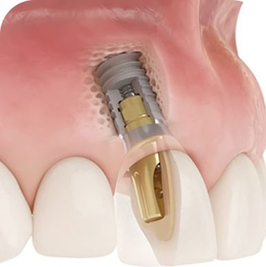 carga-dentaria