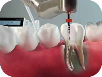 endodontia